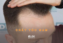 Phân biệt loại chất tóc nam và một số cách chăm sóc tóc nam cơ bản